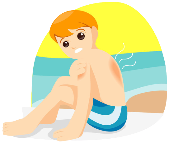 Child-sunburn